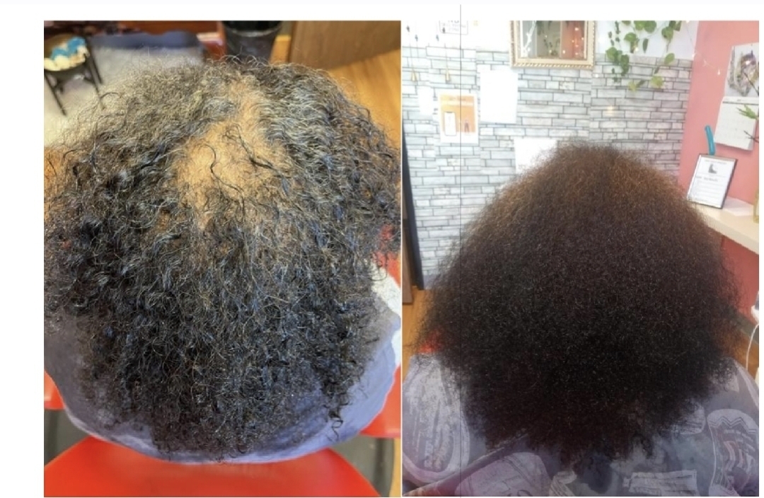 Approved client comparison: top and back of the hair photographed before on the left and after on the right.