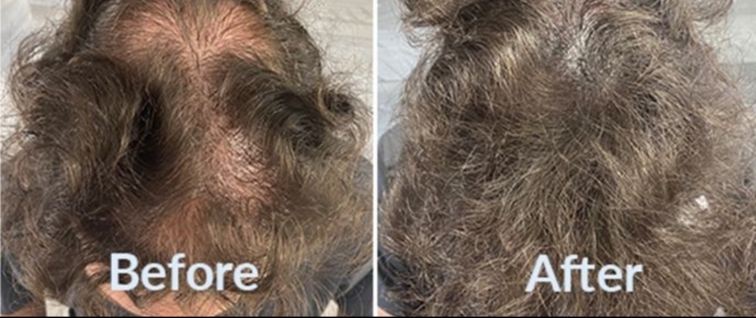 Approved client comparison: curly hair part photographed before on the left and after on the right.